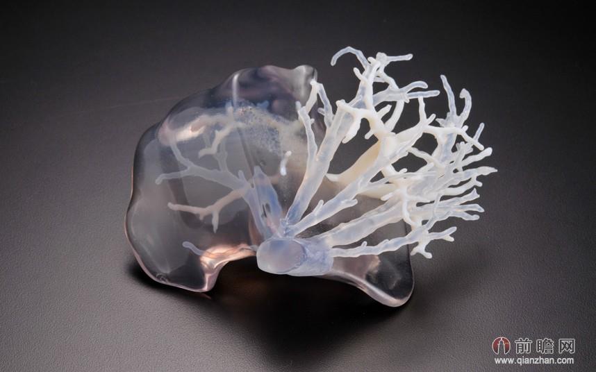 阿塔拉利用3d打印机打印的透明肝脏模型,所用材料为感光聚合树脂