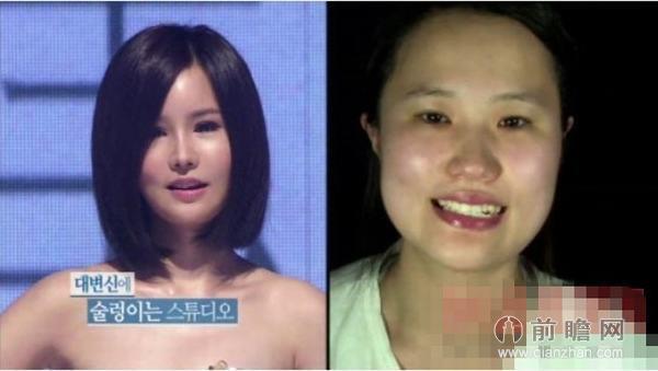 神一样的整容术!韩国惊人新案例(19)