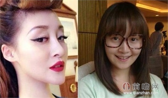 徐海星整容前后:面容惊悚吓坏网友