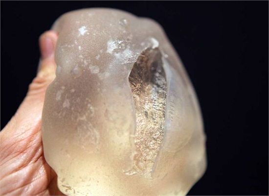 52岁<em>女子丰胸</em>11年一碰就肿 被迫割胸取出2碗