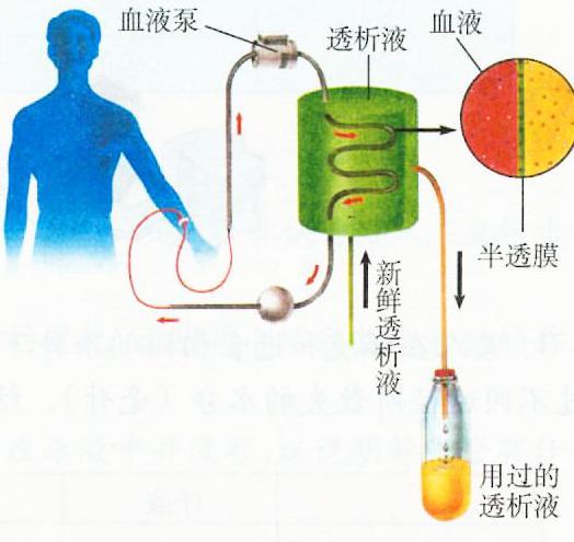 血液透析需求增长 产业现状解析