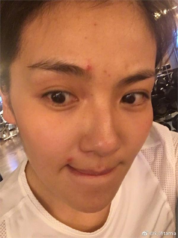 刘涛晒素颜照脸上痘痘吓人 原来她真实肤色这么黑