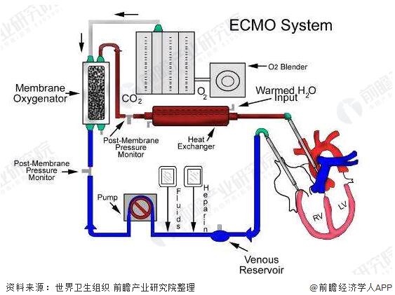 硬核!67台ecmo已发往湖北 神奇"人工肺"能从死神手中抢时间