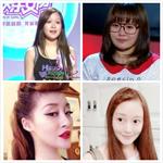 昔日好声音学员<em>徐海星</em>变尖脸 被指整容成瘾