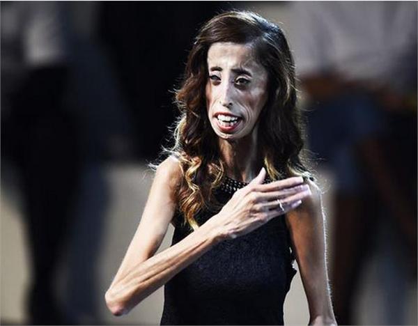 "世界最丑女人"丽兹·维拉斯奎兹的故事成为美国坊间的最新励志传奇