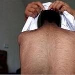 6岁男童全身长满黑毛 其母曾怀四子仅他一人存活