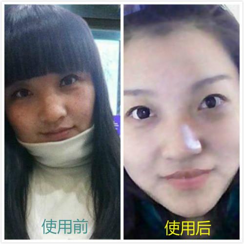 淡斑产品哪个牌子好用,好的祛斑产品推荐给你