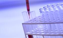 <em>返老还童</em>？科学研究称“青春之泉”的秘密可能藏在年轻人的血液中