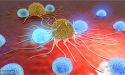 癌症一定是绝症吗？最新科学研究让其往成为慢性病的路上又迈进了一步！