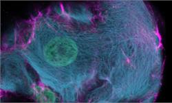 肝细胞中异常的细胞分裂尚搞不清原因 一种新基因工具“CRISPR-<em>HOT</em>”应运而生
