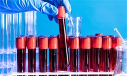 病原菌的天堂，人类的<em>炼狱</em>---新策略或能对抗细菌性败血症