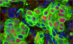 为什么简单的肺部感染会转为长期的肺部损伤？科学家发现可治疗肺部疾病的关键蛋白质