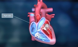 收藏！2023年全球心室辅助装置技术市场现状及竞争格局分析 中国专利申请占比最高