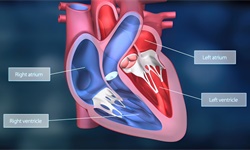 独家！2023年全球心室辅助器械技术龙头企业市场竞争格局分析 美敦力VS雅培