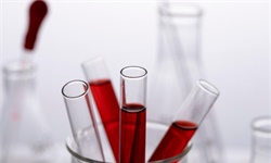 2024年中国血液净化耗材行业发展现状分析 血液净化耗材集采加速推进