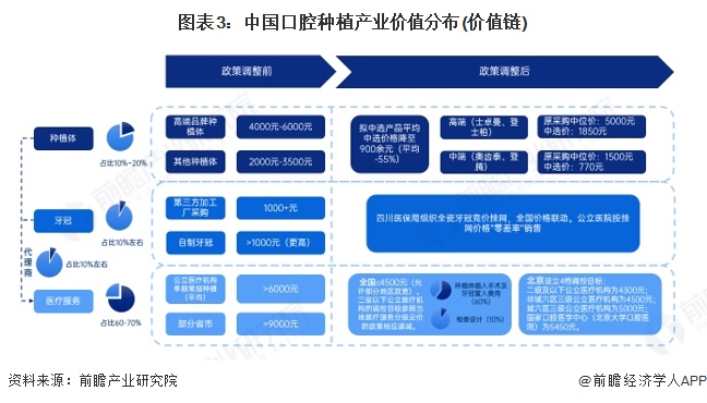 图表3：中国口腔种植产业价值分布(价值链)