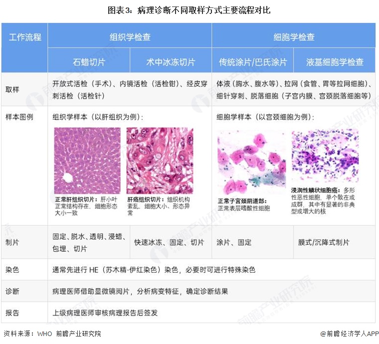 图表3：病理诊断不同取样方式主要流程对比